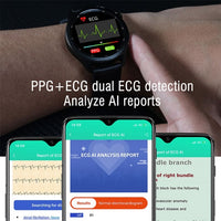 E102 Smart Watch 1.3in Screen Advanced Health Monitoring Sports Modes - watch Noco